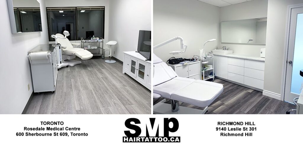 SMP hair loss treatment Toronto ON