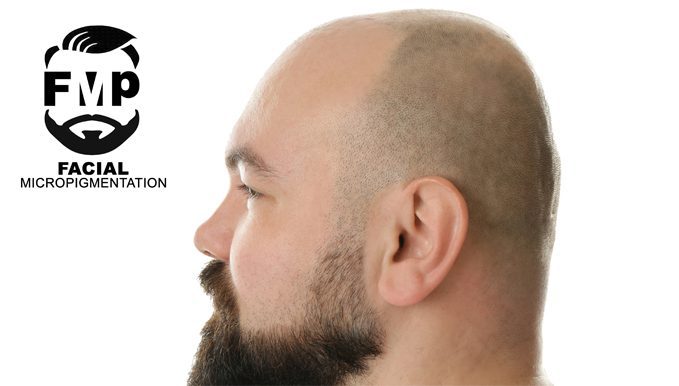 micropigmentation Toronto for beard