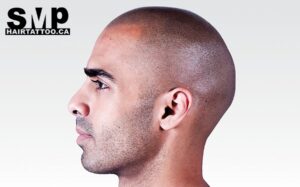 What is scalp micropigmentation hair tattoo scalp micropigmentation Toronto