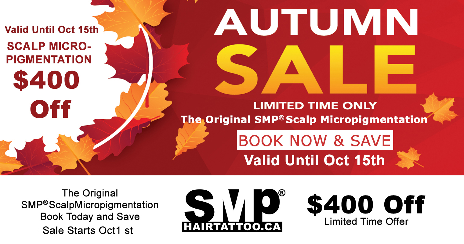 scalp micropigmentation Toronto - hair tattoo - hairline tattoo - SMP