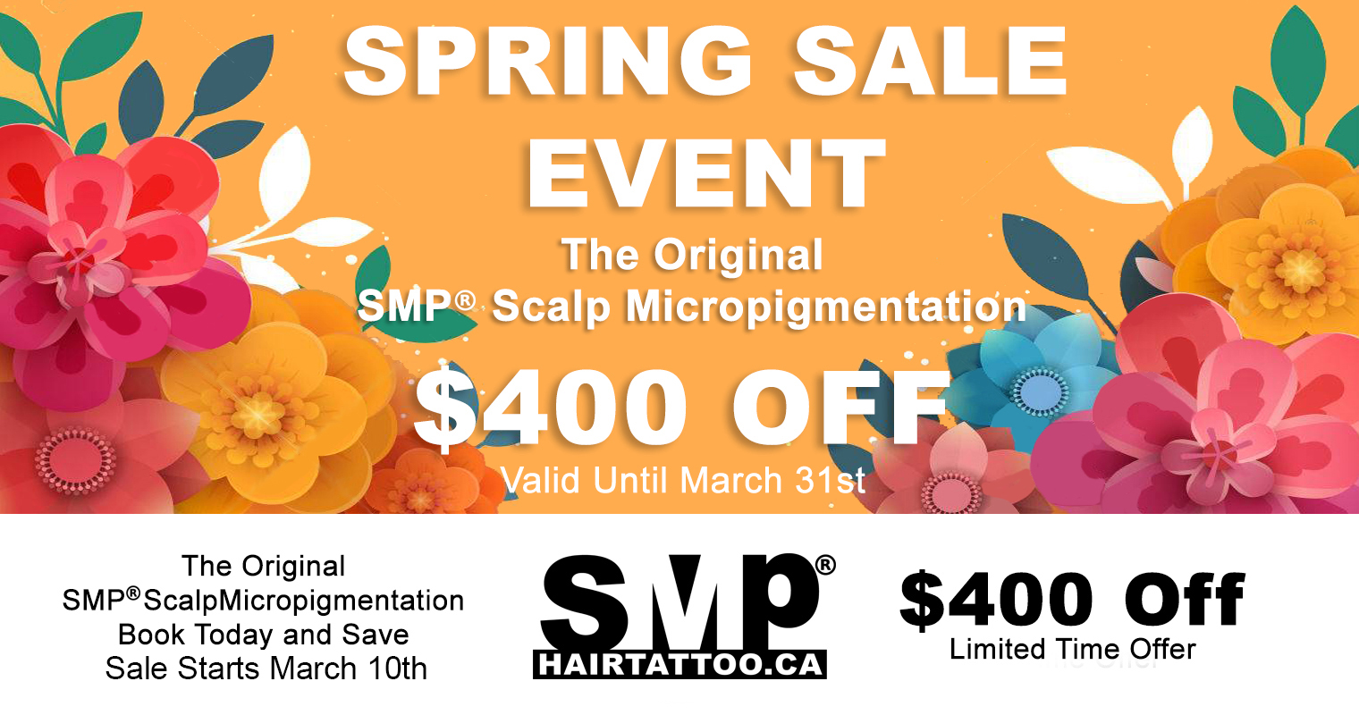 scalp micropigmentation - hair tattoo Toronto