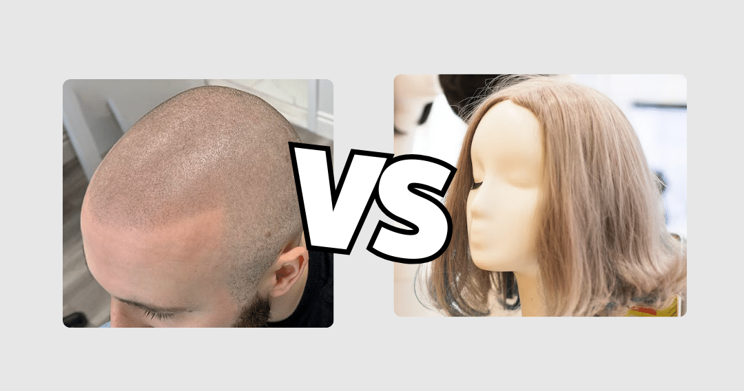 Hair Tattoos vs. Wigs Cost & Style Compare