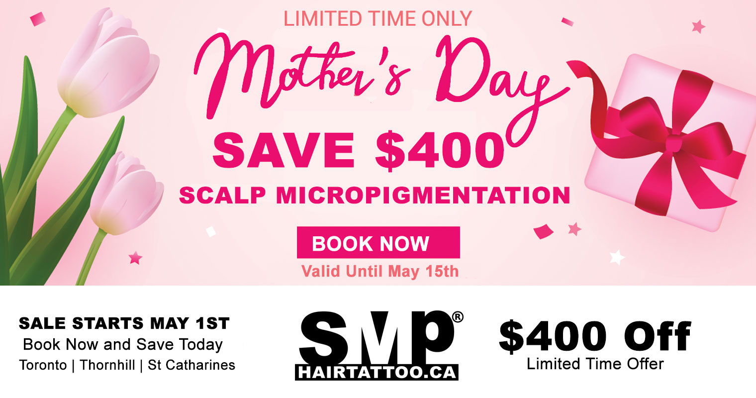 scalp-micropigmentation-Toronto-hair-tattoo