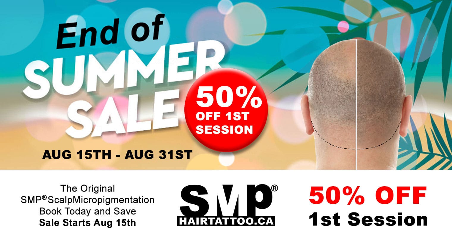 Scalp-Micropigmentation-Hair-Tattoo