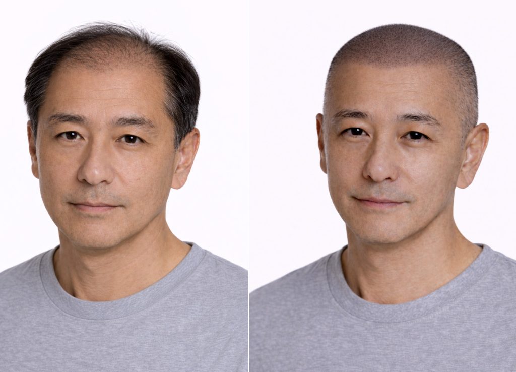 how-do-i-look-with-a-hair-tattoo