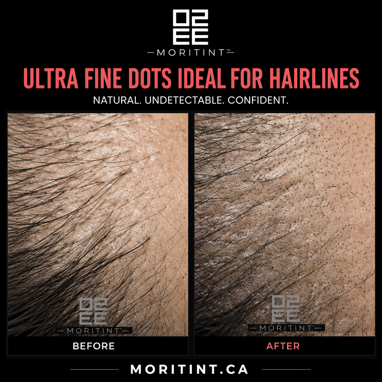 MoriTint Hair Density Enhancement